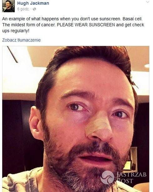 Hugh Jackman apeluje o ochronę skóry