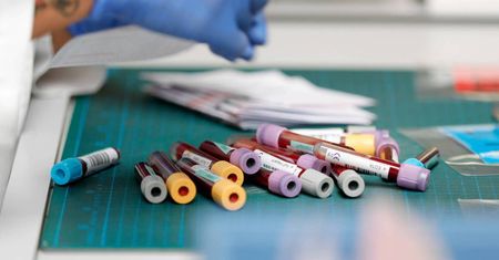 Zidentyfikowano ludzkie przeciwciało, które blokuje SARS-CoV-2