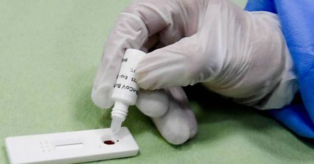 Prezes URPL apeluje, by nie kupować testów na COVID-19, które mają być stosowane w domu