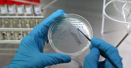 E.coli może mieć związek z rakiem jelita grubego