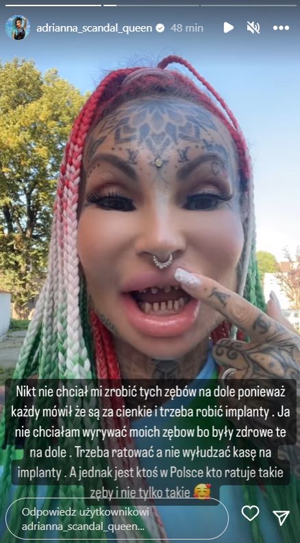 Adrianna Eisenbach kazała spiłować sobie zęby (fot. InstaStories)