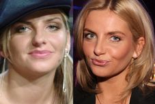 Co się stało z twarzą Frytki?