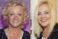 Kurowska młodnieje. Czy to cud?!