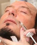 Jacyków szprycuje się botoksem