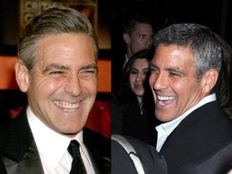 Nowe zęby Clooneya!