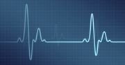Opaska Nymi - autoryzacja za pomocą EKG