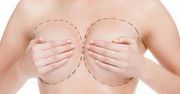 Dlaczego kobiety zmniejszają piersi?