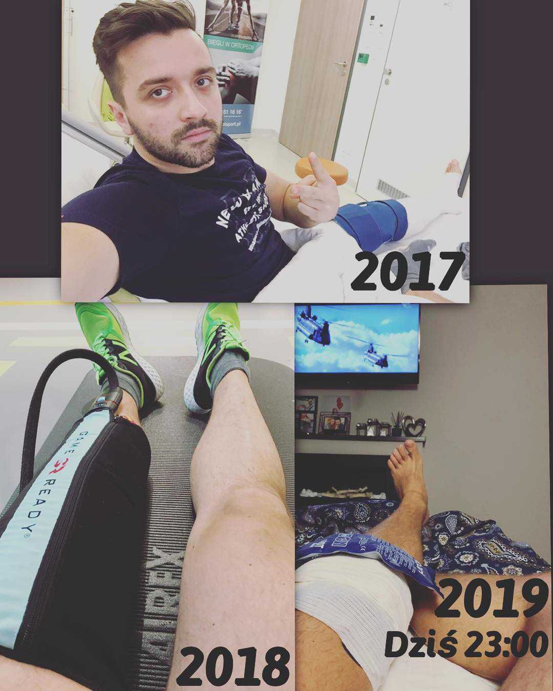 Rafał Szatan pokazał swoje zmiażdżone kolano