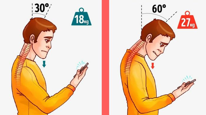 Wady postawy to plaga XXI wieku - konsekwencja pozycji, w jakiej przeglądamy smartfony