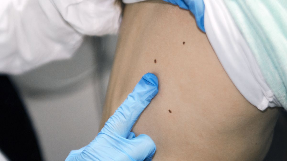 Amerykanka miała na plecach gigantyczną narośl przypominającą ząb (zdj. ilustracyjne)