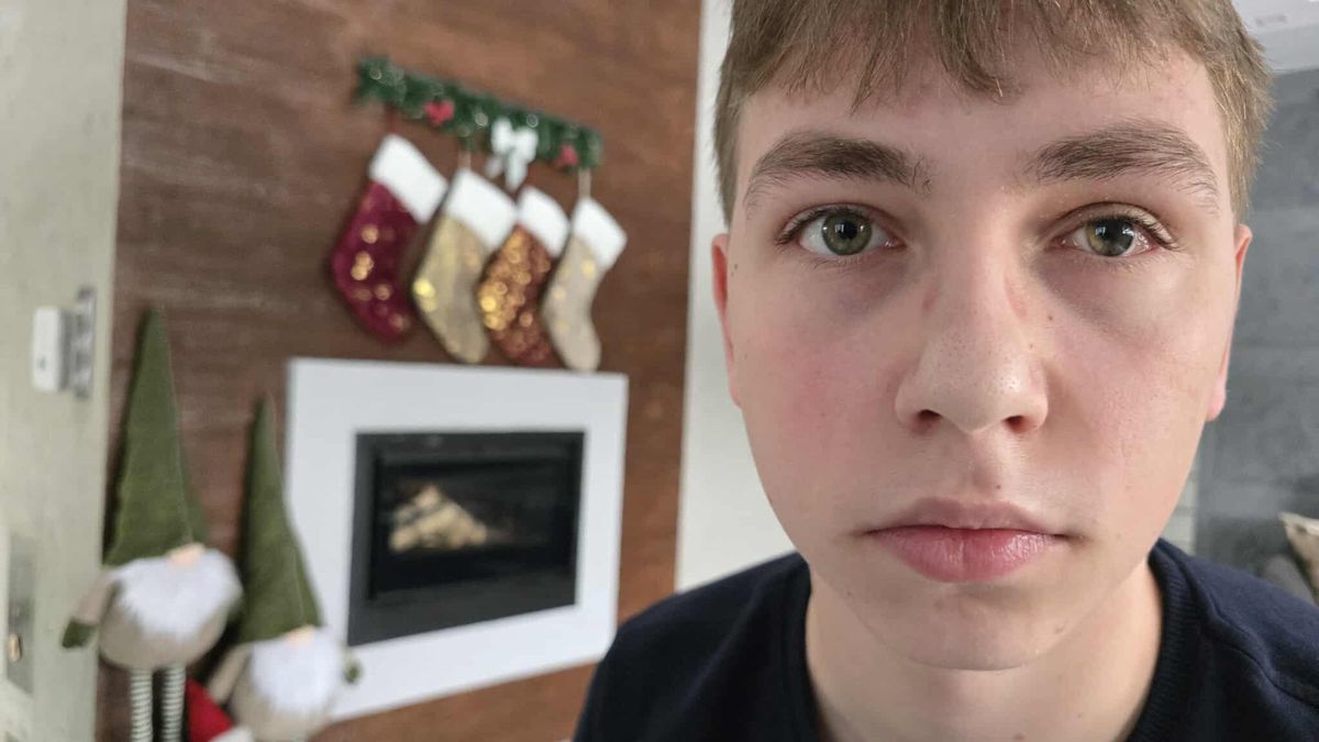 16-letni Patryk Bułatowicz nie widzi na lewe oko