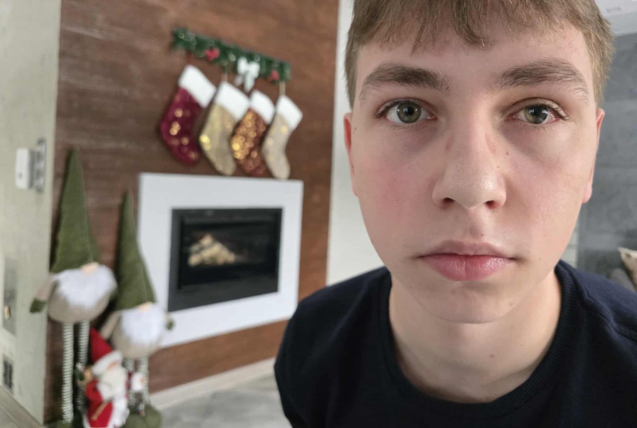 Strzał mógł zabić 16-latka. "Mamo, niech oni mi już wyjmą to oko"