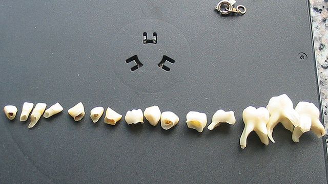 Koniec z próchnicą - Colgate opracował inteligentną pastę do zębów 1