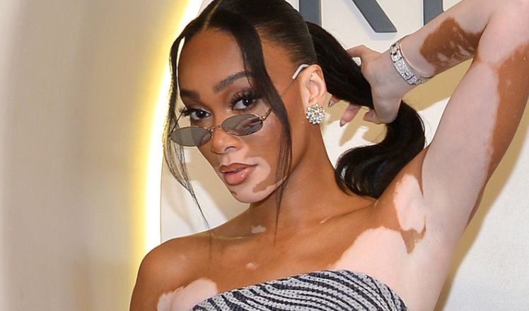 Winnie Harlow odsłania smukłe ciało w kusym komplecie na imprezie