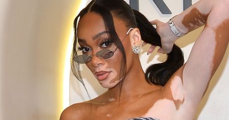 Winnie Harlow odsłania smukłe ciało w kusym komplecie (ZDJĘCIA)