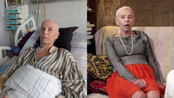 Hanna Bieluszko przyjęła diagnozę ze spokojem. O walce z chorobą mówi: "Miałam taki moment, że nie wiadomo było, czy przeżyję"