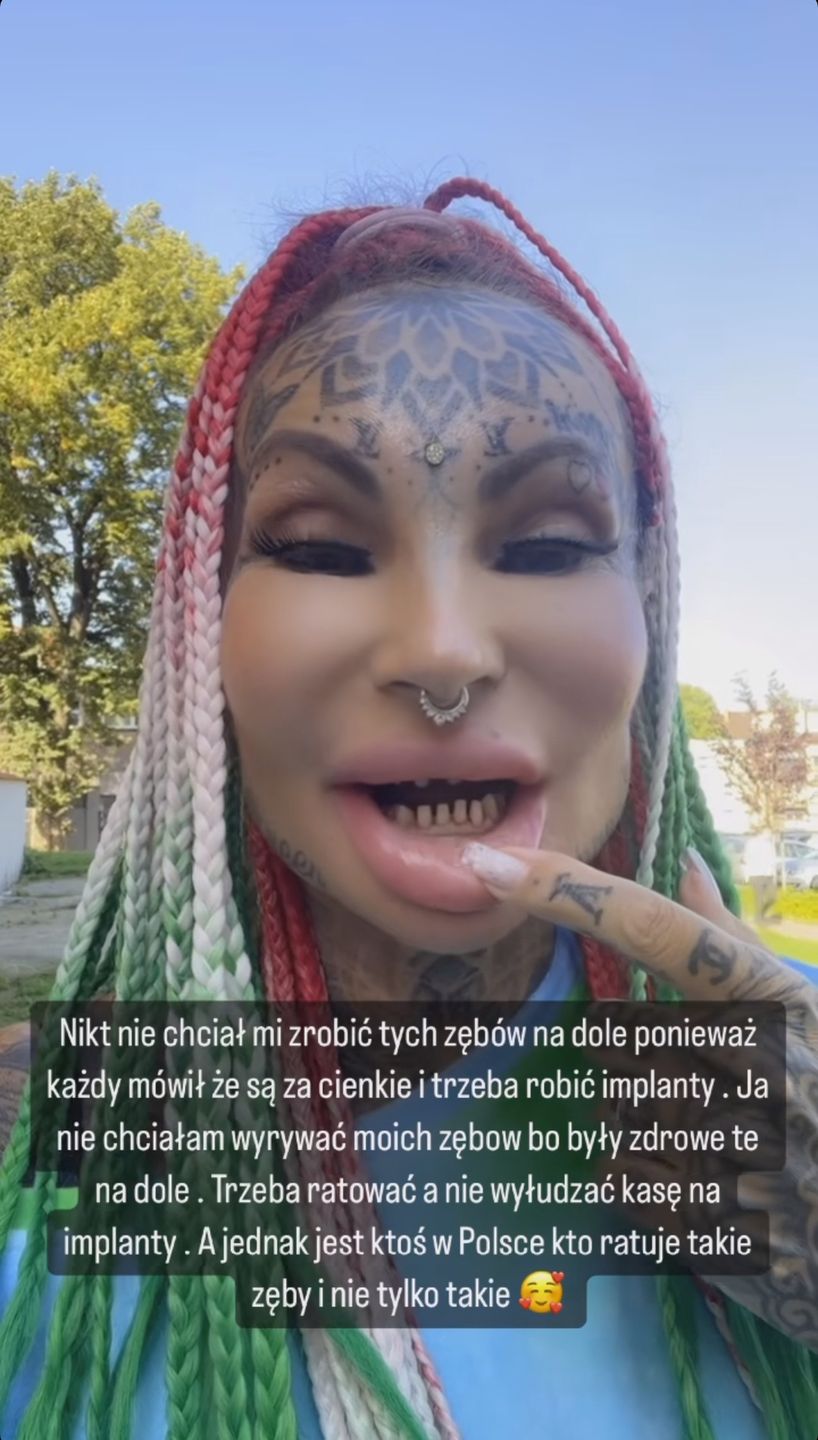 Adrianna Eisenbach spiłowała zęby