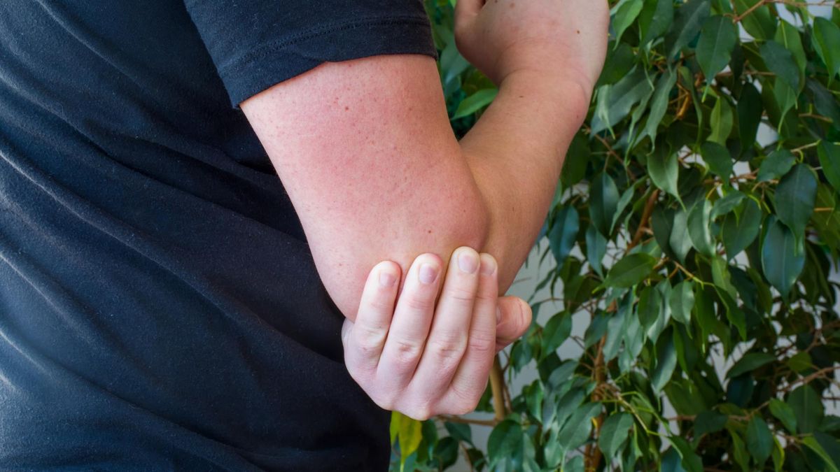 Bóle stawów. Kiedy są alarmujące i na jakie schorzenia mogą wskazywać?