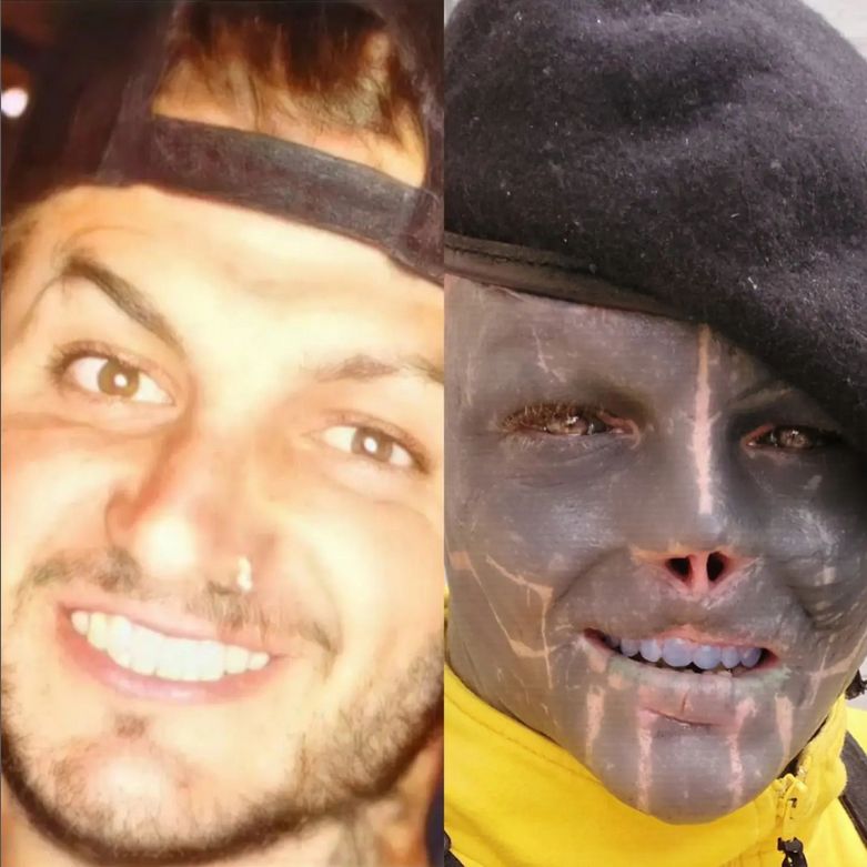 Anthony Loffredo 