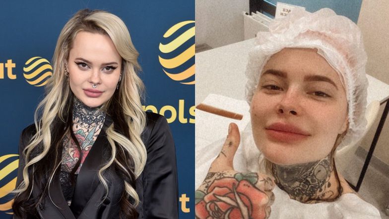 Monika Miller jest już po przeszczepie włosów