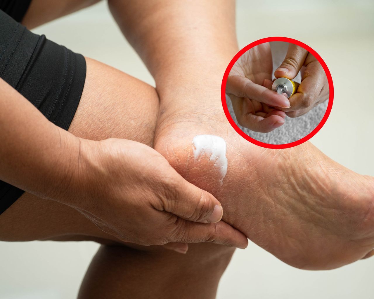 Geheimtipp aus der Apotheke: Die beste Salbe gegen rissige Fersen
