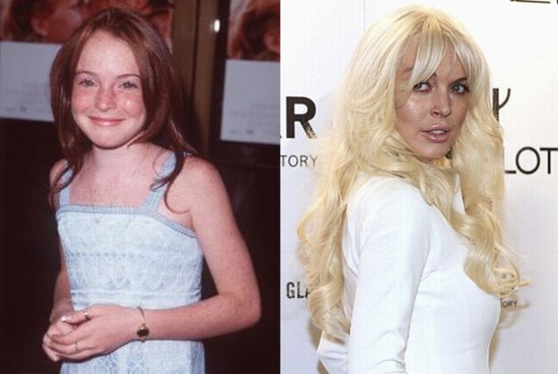 Tak zmieniała się twarz Lindsay! (WIDEO)