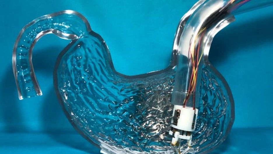 Makieta żołądka z wprowadzoną drukarką 3d