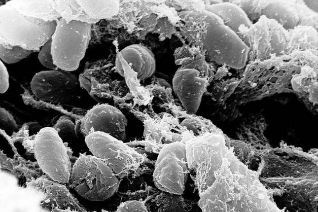 9 najgroźniejszych epidemii w historii ludzkości 8