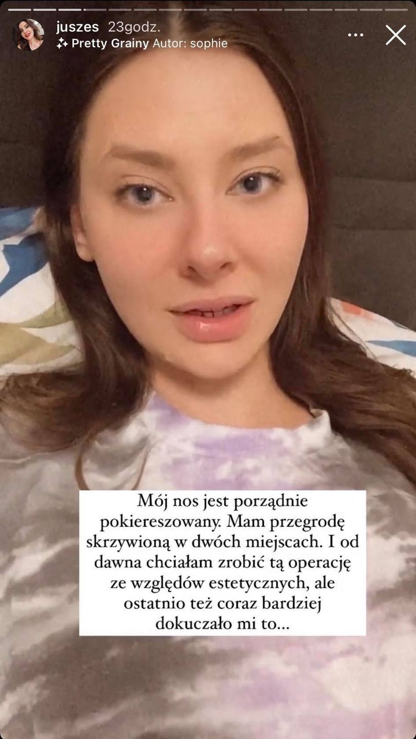 Justyna z "Big Brothera" przeszła operację plastyczną nosa
