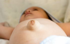 Przepuklina pępkowa u niemowlaka – objawy, przyczyny, i leczenie