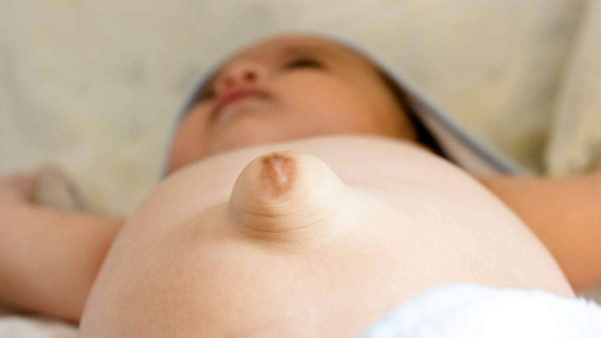 Przepuklina pępkowa u niemowlaka