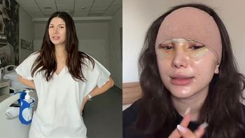27-letnia Agata Lewandowska zdradza, ile zapłaciła za LIFTING! "Dużo, dużo kosztów...". Warto było?