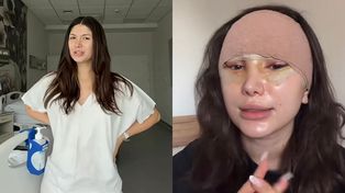27-letnia Agata Lewandowska zdradza, ile zapłaciła za LIFTING! "Dużo, dużo kosztów...". Warto było?