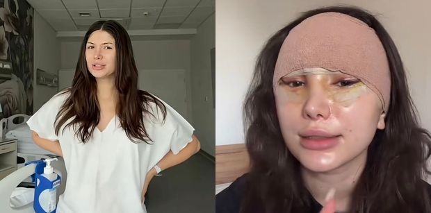27-letnia Agata Lewandowska zdradza, ile zapłaciła za LIFTING! "Dużo, dużo kosztów...". Warto było?