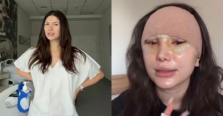 27-letnia Agata Lewandowska zdradza, ile zapłaciła za LIFTING! "Dużo, dużo kosztów...". Warto było?