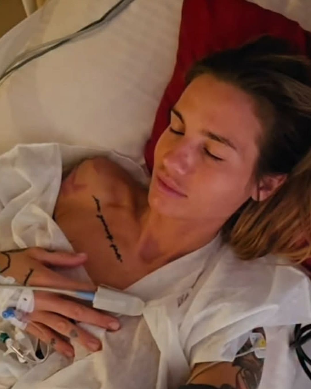 Karolina Gilon przeszła operację piersi