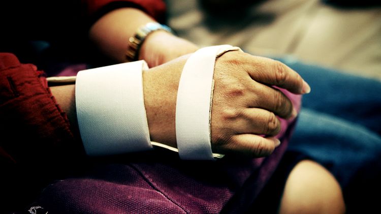 Złamania kości śródręcza i palców ręki