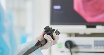 Mało znany czynnik rozwoju raka jelita grubego. To dlatego chorują coraz młodsi