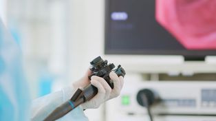 Mało znany czynnik rozwoju raka jelita grubego. To dlatego chorują coraz młodsi