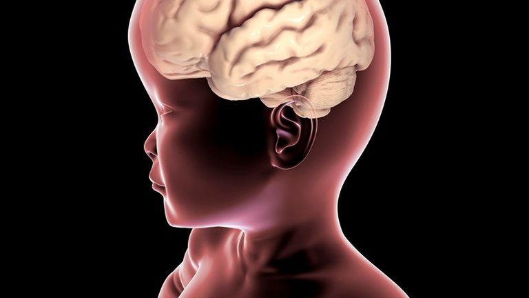 Choroba Canavan atakuje układ nerwowy dziecko, stopniowo niszcząc mózg
