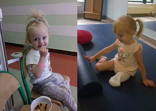 Natalka musi żyć bez jednej nóżki