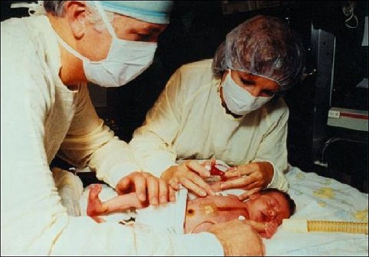 Dr Bailey wykonał przeszczep