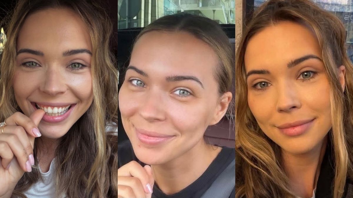 Sandra Kubicka pokazała się 20 dni po operacji 