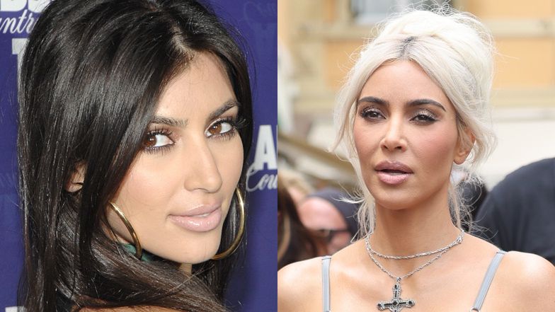 Gwiazdy, które zrobiły sobie nos