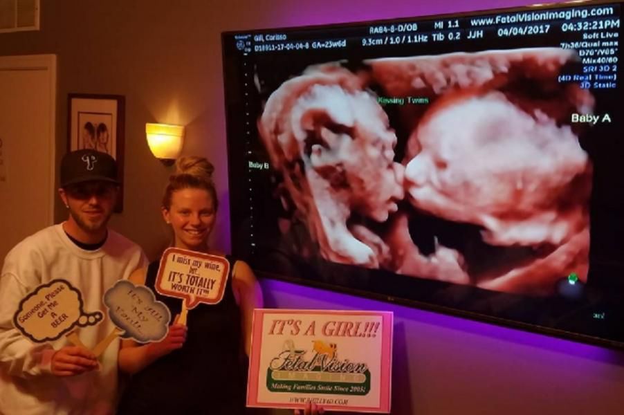 Niezwykły gest bliźniaczek w łonie matki. To zdjęcie USG podbija sieć