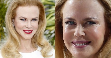 Twarz Nicole Kidman w Cannes! STRASZNA?