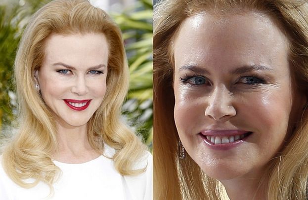 Twarz Nicole Kidman w Cannes! STRASZNA?