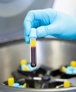 Wrocław. Dramatyczne braki krwi. Apel RCKiK o pomoc