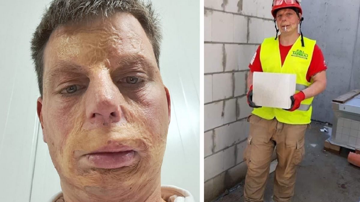 Prosił internautów o pomoc. Fundacja nie wypłaci mu pieniędzy ze zbiórki