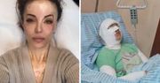 Katarzyna Dacyszyn została oblana kwasem przez stalkera. Dziś inspiruje inne kobiety